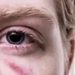 Kako Pružiti Sigurno Utočište Ženama