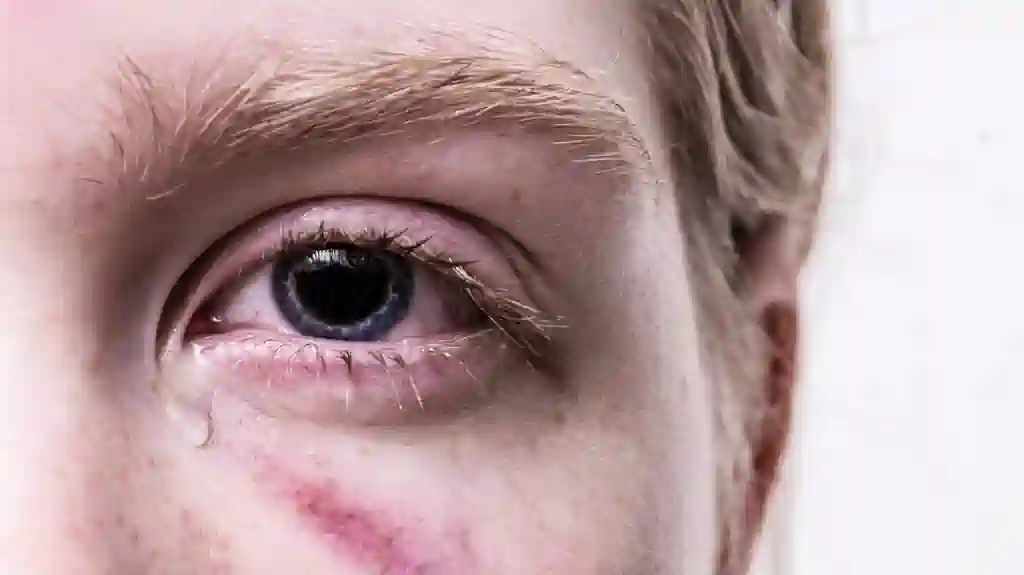 Kako Pružiti Sigurno Utočište Ženama